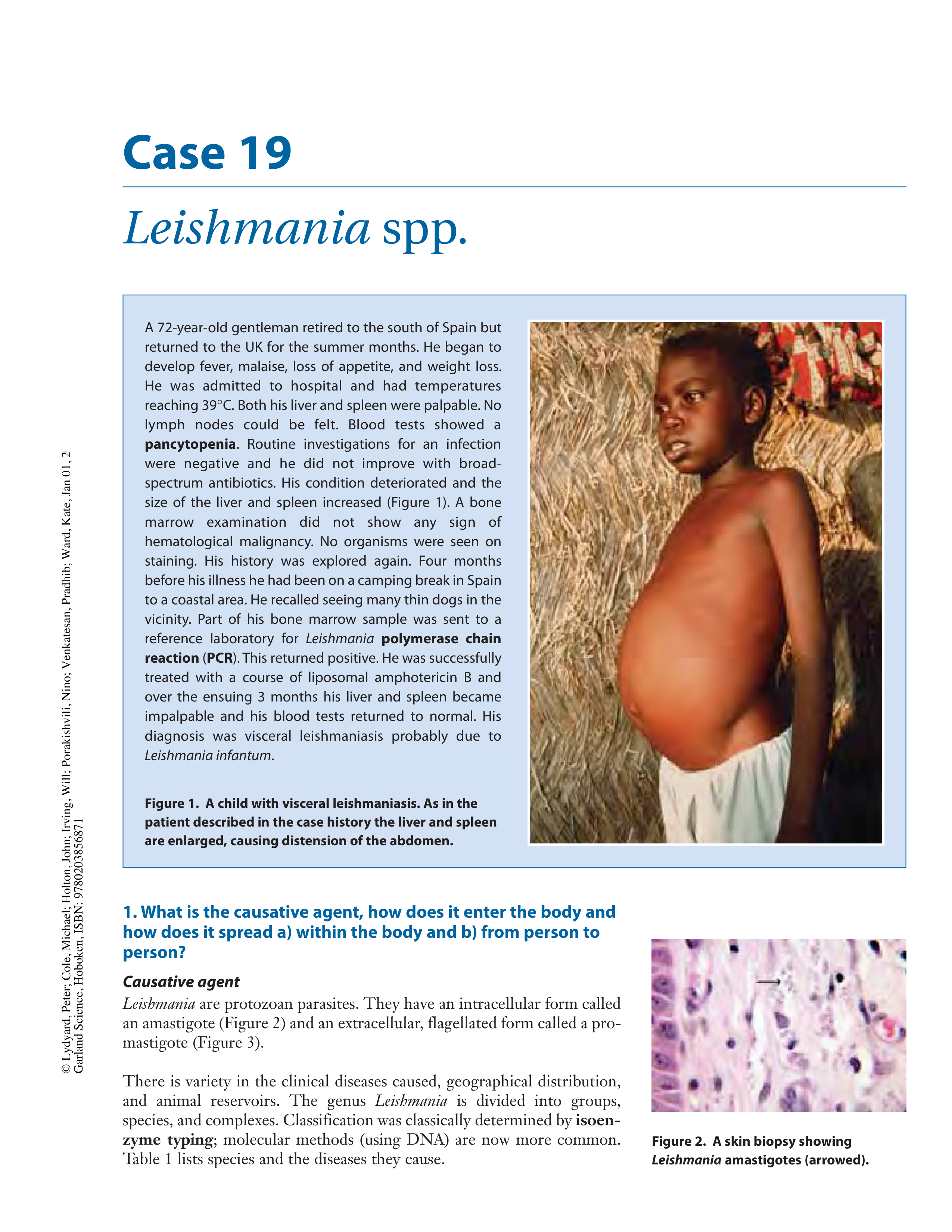 Case19 - Leishmania_d8ehxt5ksqq_page1