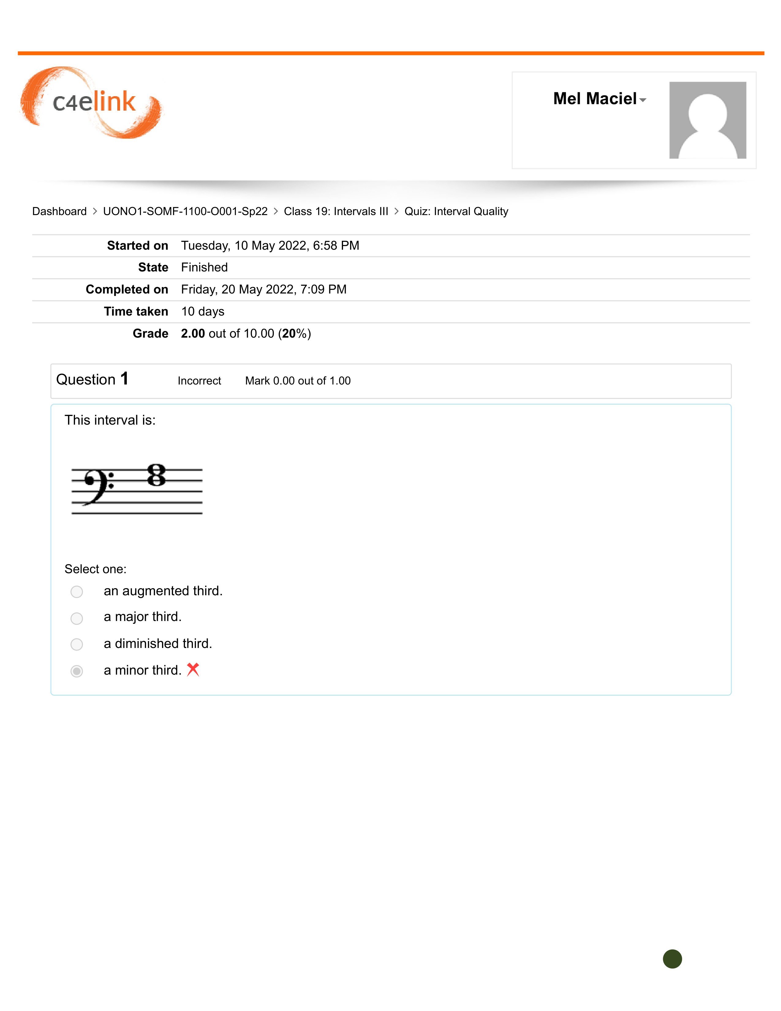 Quiz_ Interval Quality.pdf_dc9u8ugnfq3_page1