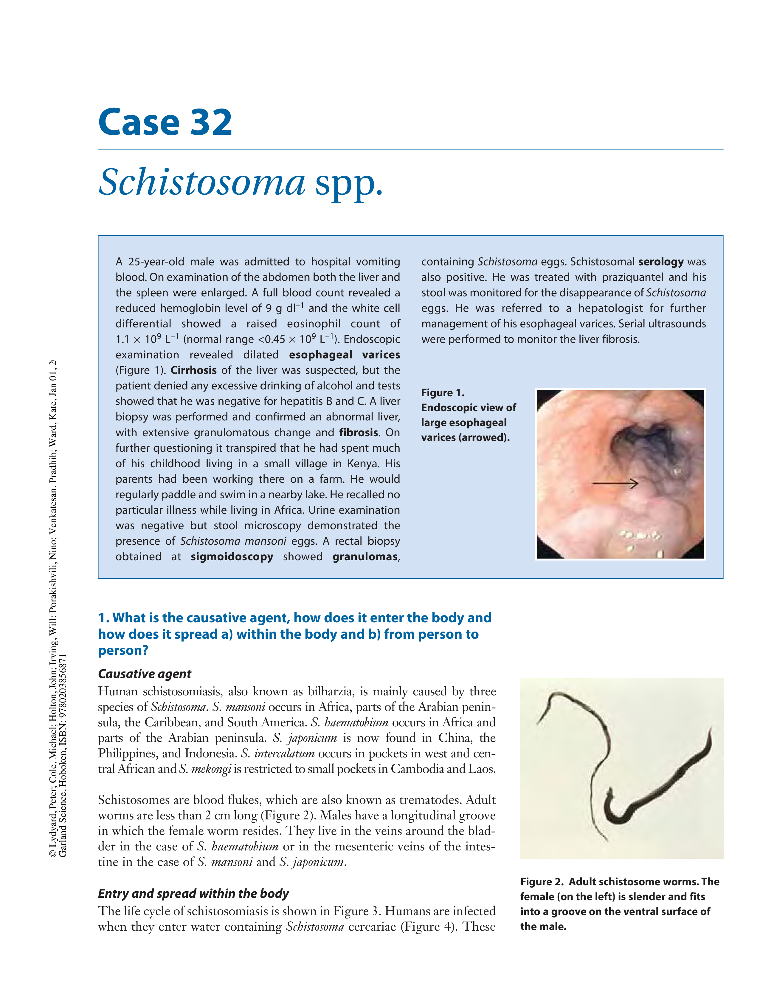 case32 - Schistosoma_dcdd7evukoy_page1