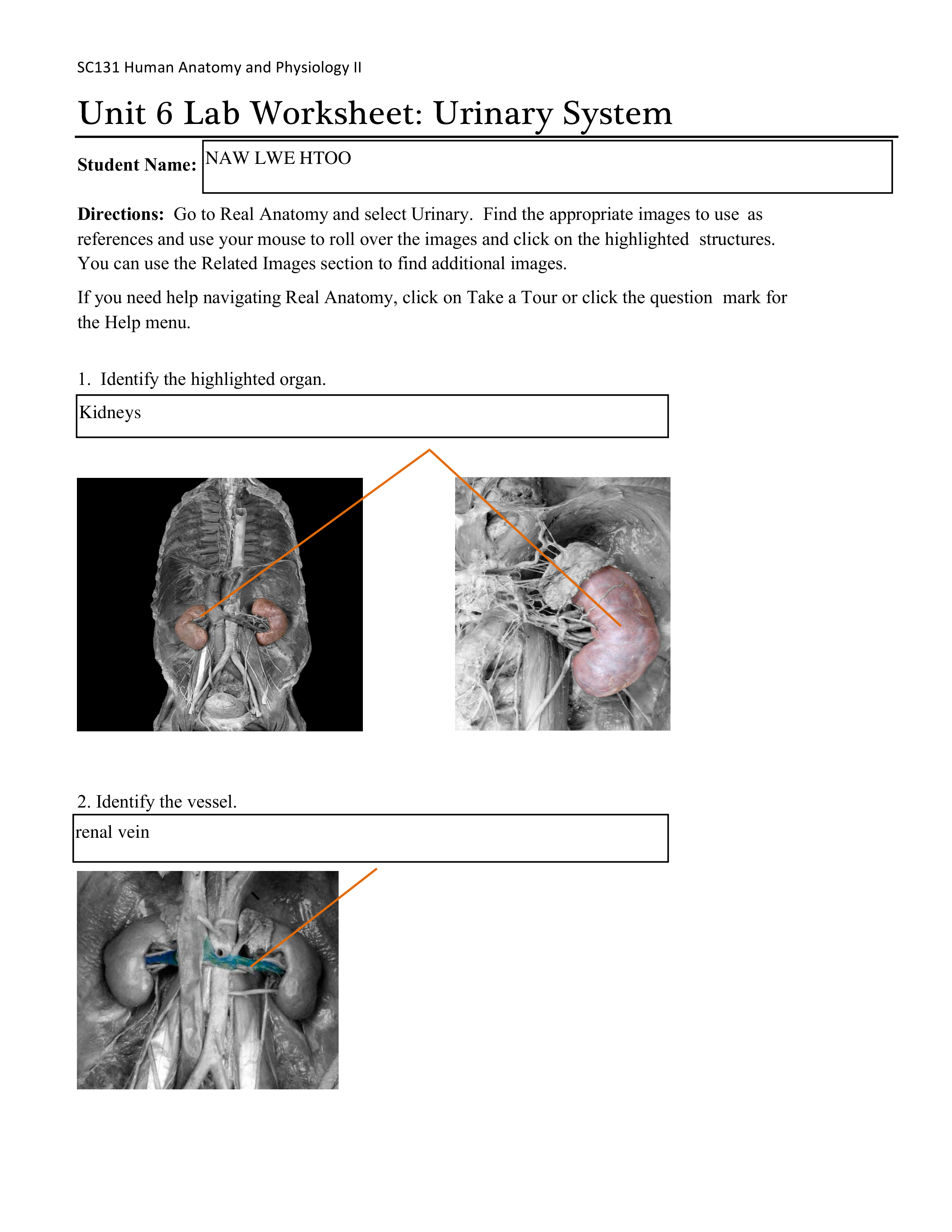 A&P 2 UNIT 6 ASSIGNMENT 2_dkagroptpnr_page1