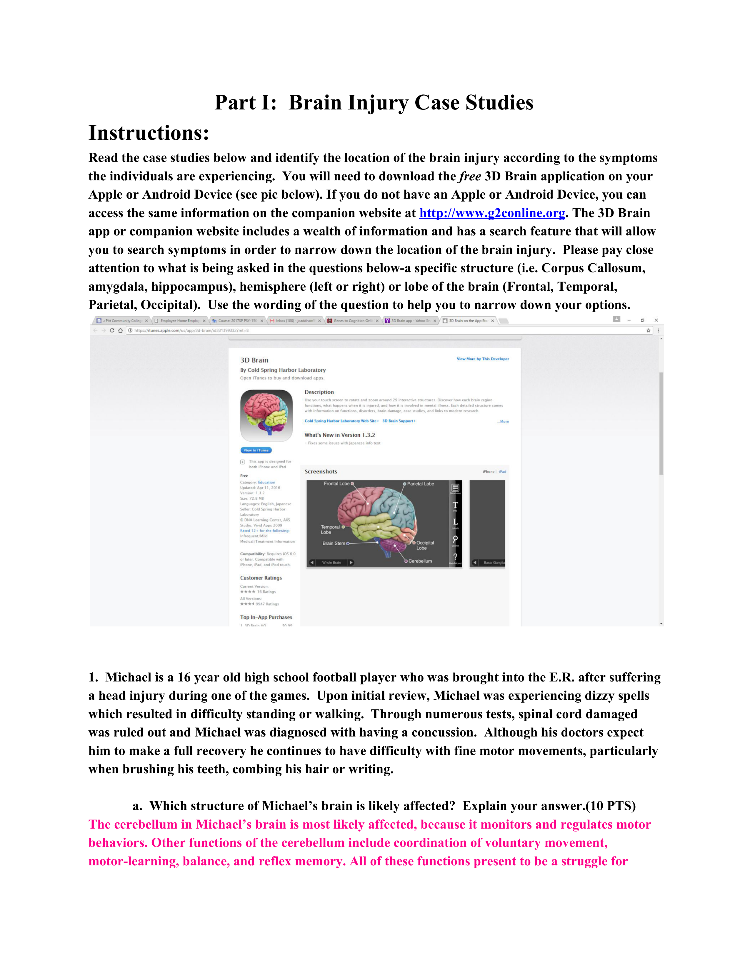 Brain Injury Case Studies.pdf_doz6up2he4v_page1