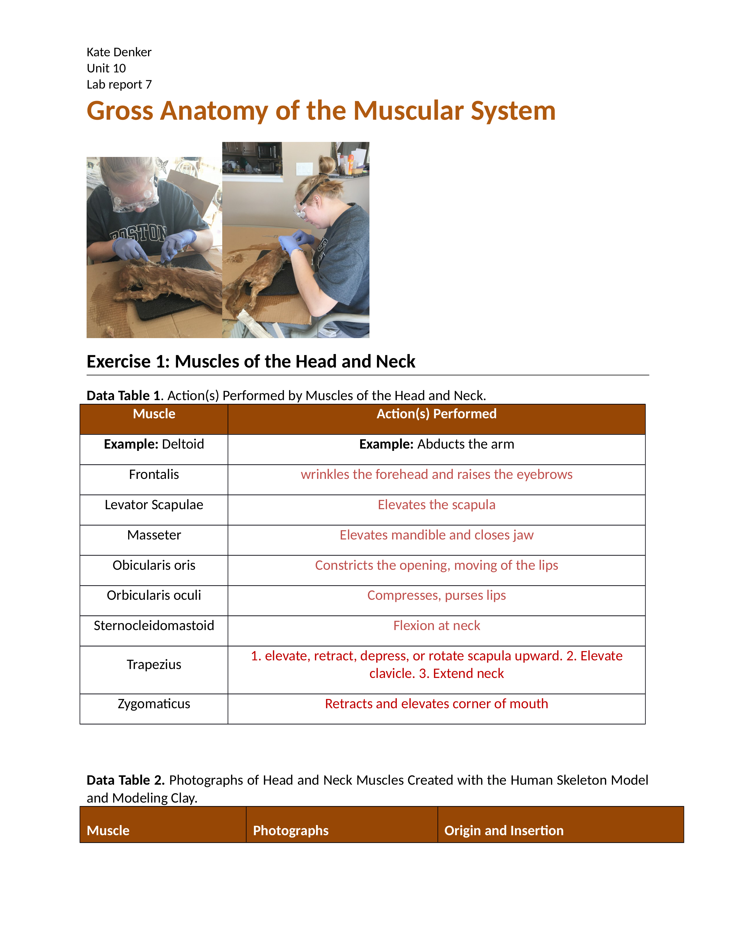 Gross Anatomy of the Muscular System_drbqdbf92sr_page1