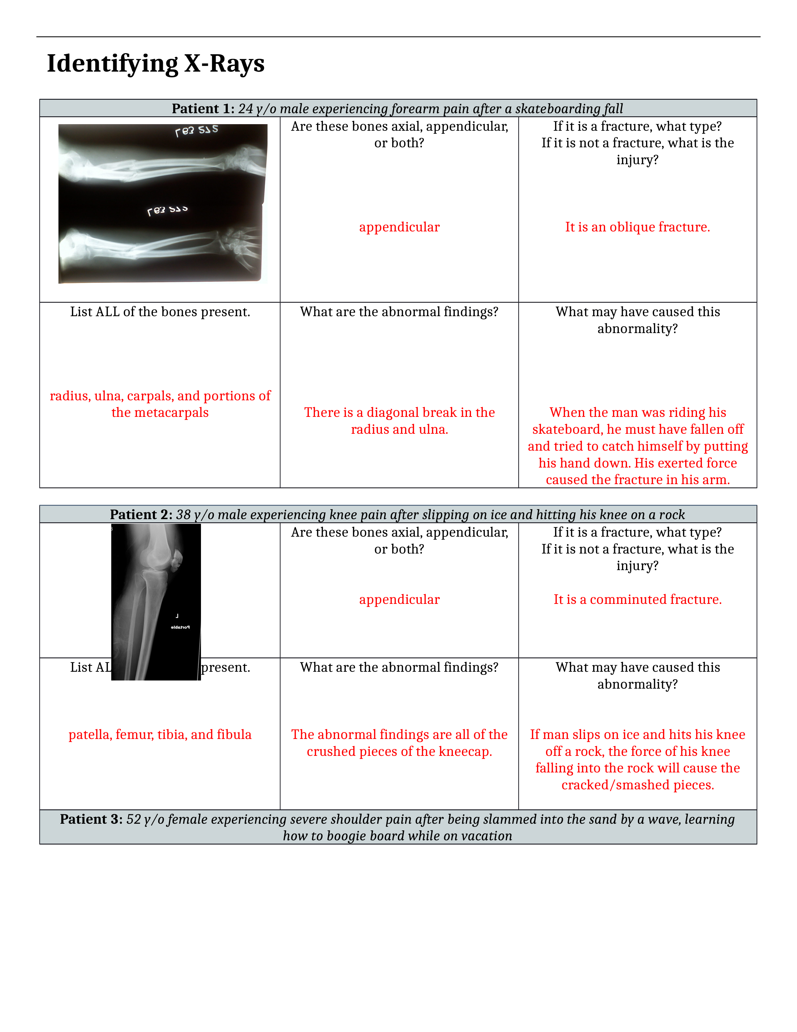 X-Rays and Fractures.docx_du7mpfkadbh_page1