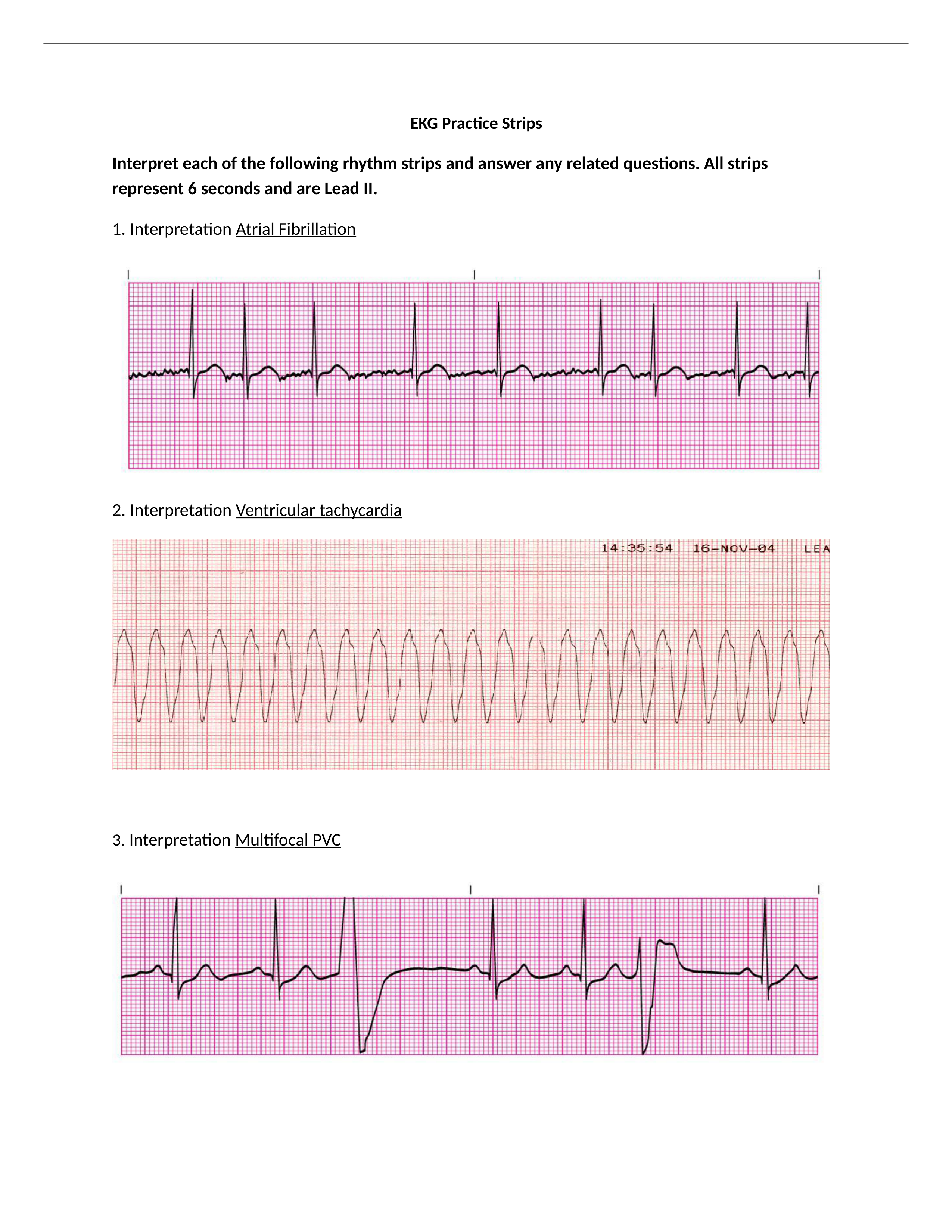 EKG Packet F20.docx_dv3p7gqqxqp_page1