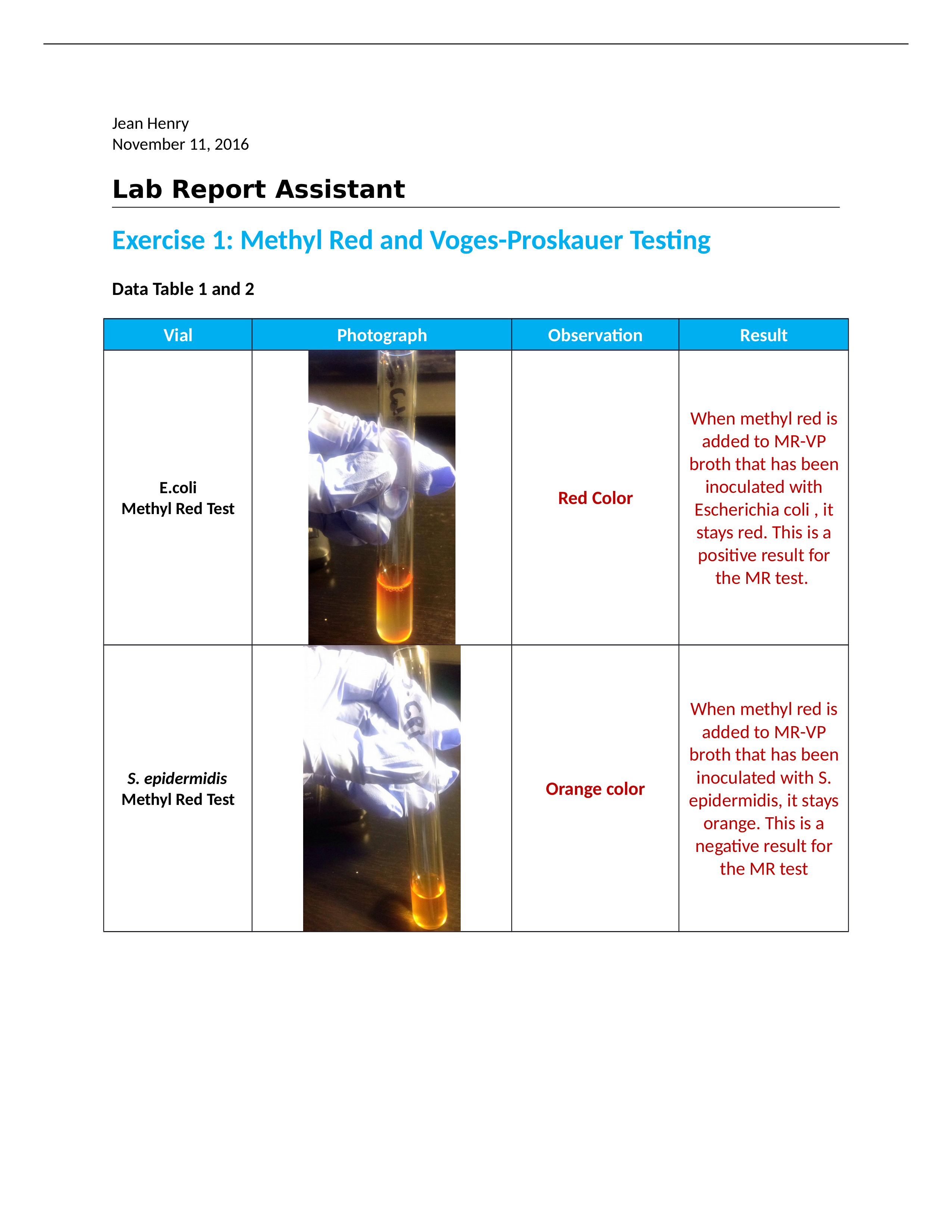 Biochemical Testing for Microbial Identification - Carbohydrate Fermenation Testing. - TMP_dvnaitm99qz_page1