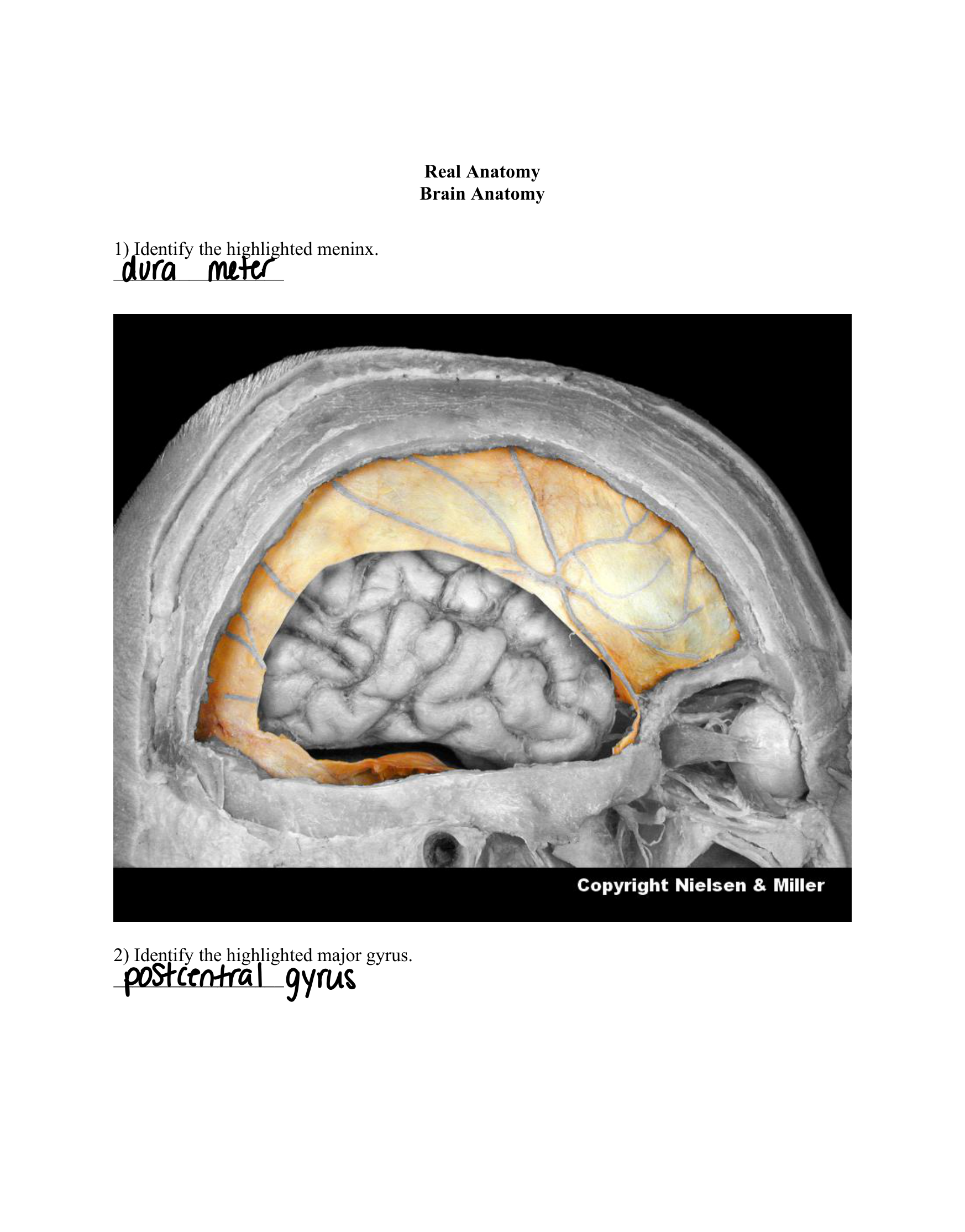 28_brain_anatomy_Worksheet.pdf_dwb6apmdhi7_page1