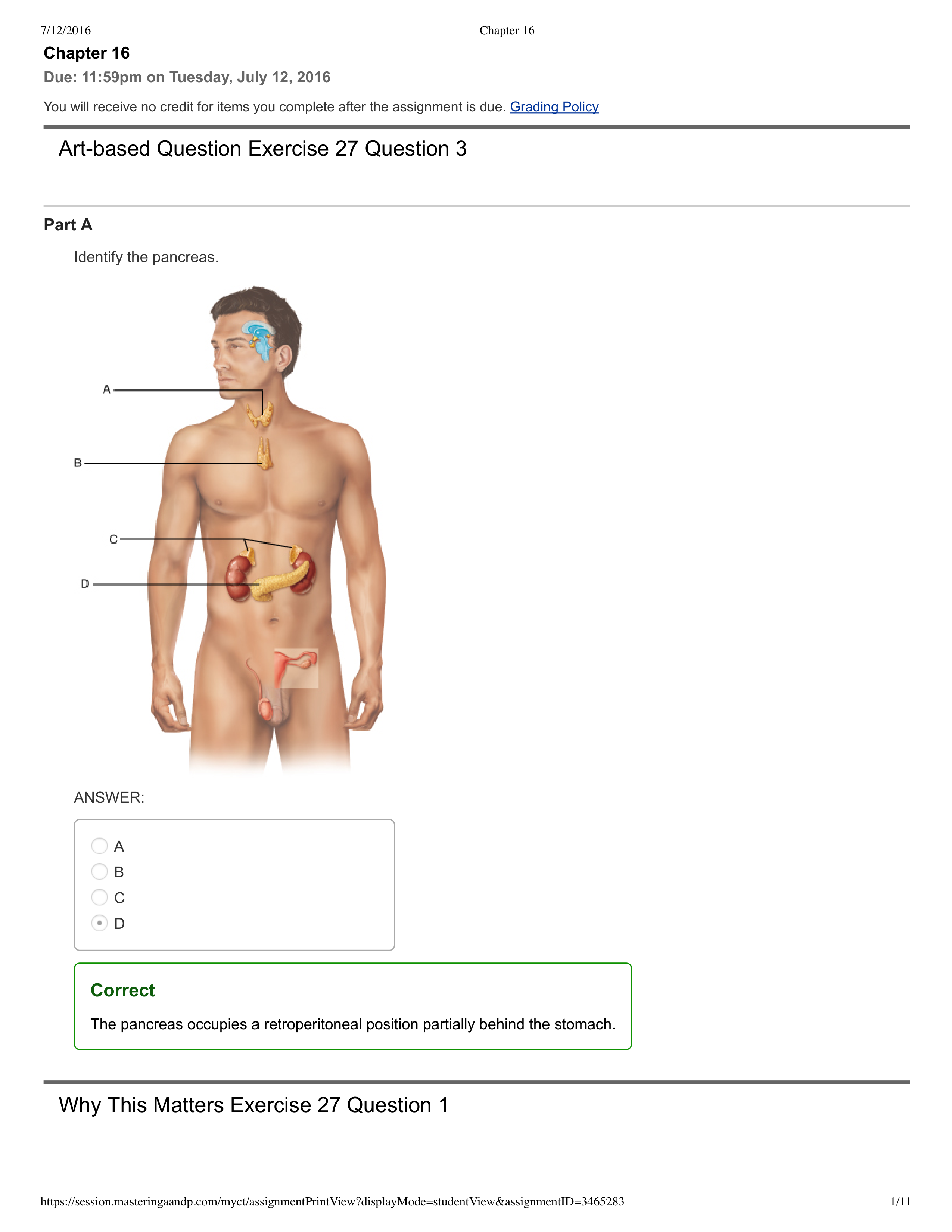 Lab - Chapter 16_dxj4l4mmdtm_page1