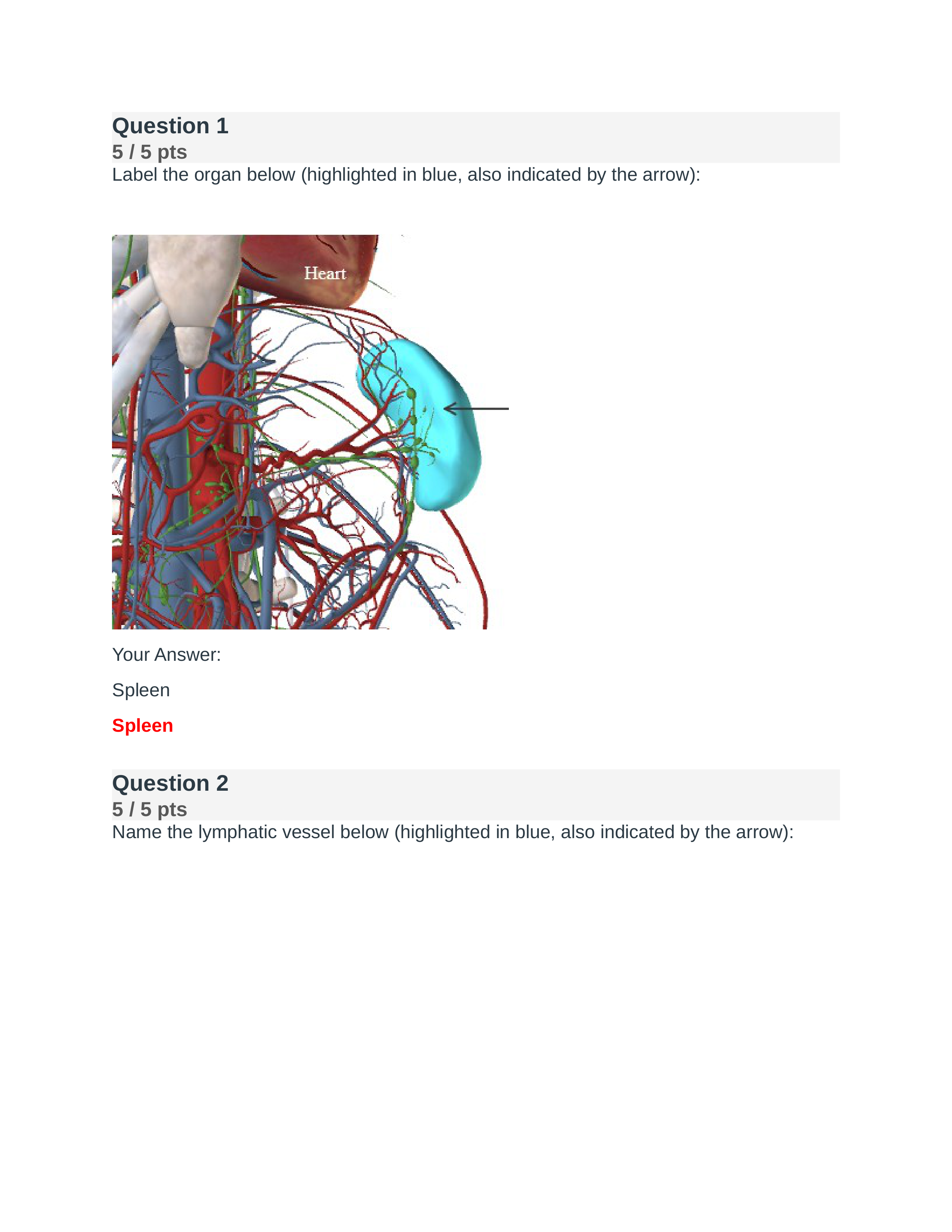 AP II - Module 5 Exam.docx_dyc1vtswyzb_page1