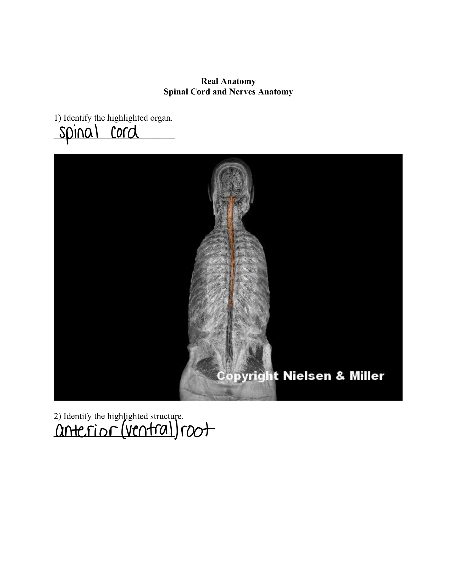 30_spinal_cord_and_nerves_anatomy_Worksheet.pdf_dz3mrbd79qt_page1