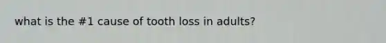 what is the #1 cause of tooth loss in adults?