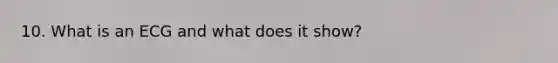 10. What is an ECG and what does it show?