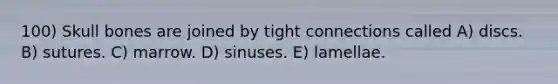 100) Skull bones are joined by tight connections called A) discs. B) sutures. C) marrow. D) sinuses. E) lamellae.