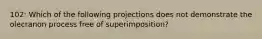 102: Which of the following projections does not demonstrate the olecranon process free of superimposition?