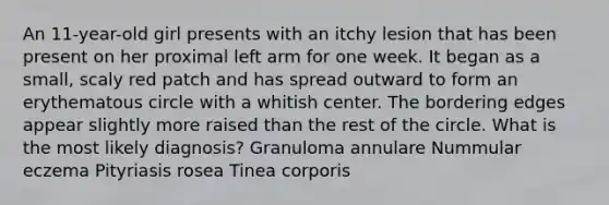 An 11-year-old girl presents with an itchy lesion that has been present on her proximal left arm for one week. It began as a small, scaly red patch and has spread outward to form an erythematous circle with a whitish center. The bordering edges appear slightly more raised than the rest of the circle. What is the most likely diagnosis? Granuloma annulare Nummular eczema Pityriasis rosea Tinea corporis