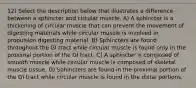 12) Select the description below that illustrates a difference between a sphincter and circular muscle. A) A sphincter is a thickening of circular muscle that can prevent the movement of digesting materials while circular muscle is involved in propulsion digesting material. B) Sphincters are found throughout the GI tract while circular muscle is found only in the proximal portion of the GI tract. C) A sphincter is composed of smooth muscle while circular muscle is composed of skeletal muscle tissue. D) Sphincters are found in the proximal portion of the GI tract while circular muscle is found in the distal portions.