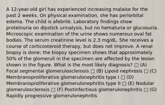 A 12-year-old girl has experienced increasing malaise for the past 2 weeks. On physical examination, she has periorbital edema. The child is afebrile. Laboratory findings show proteinuria on dipstick urinalysis, but no hematuria or glucosuria. Microscopic examination of the urine shows numerous oval fat bodies. The serum creatinine level is 2.3 mg/dL. She receives a course of corticosteroid therapy, but does not improve. A renal biopsy is done; the biopsy specimen shows that approximately 50% of the glomeruli in the specimen are affected by the lesion shown in the figure. What is the most likely diagnosis? □ (A) Focal segmental glomerulosclerosis □ (B) Lipoid nephrosis □ (C) Membranoproliferative glomerulonephritis type I □ (D) Membranoproliferative glomerulonephritis type II □ (E) Nodular glomerulosclerosis □ (F) Postinfectious glomerulonephritis □ (G) Rapidly progressive glomerulonephritis