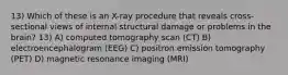 13) Which of these is an X-ray procedure that reveals cross-sectional views of internal structural damage or problems in the brain? 13) A) computed tomography scan (CT) B) electroencephalogram (EEG) C) positron emission tomography (PET) D) magnetic resonance imaging (MRI)