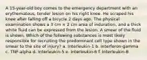 A 15-year-old boy comes to the emergency department with an erythematous, tender lesion on his right knee. He scraped his knee after falling off a bicycle 2 days ago. The physical examination shows a 3 cm × 2 cm area of induration, and a thick white fluid can be expressed from the lesion. A smear of the fluid is shown. Which of the following substances is most likely responsible for recruiting the predominant cell type shown in the smear to the site of injury? a. Interleukin-1 b. Interferon-gamma c. TNF-alpha d. Interleukin-5 e. Interleukin-6 f. Interleukin-8