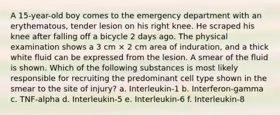 A 15-year-old boy comes to the emergency department with an erythematous, tender lesion on his right knee. He scraped his knee after falling off a bicycle 2 days ago. The physical examination shows a 3 cm × 2 cm area of induration, and a thick white fluid can be expressed from the lesion. A smear of the fluid is shown. Which of the following substances is most likely responsible for recruiting the predominant cell type shown in the smear to the site of injury? a. Interleukin-1 b. Interferon-gamma c. TNF-alpha d. Interleukin-5 e. Interleukin-6 f. Interleukin-8