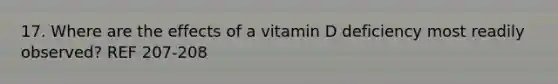 17. Where are the effects of a vitamin D deficiency most readily observed? REF 207-208