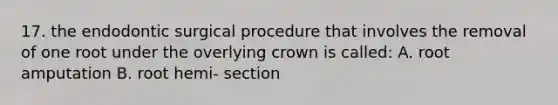 17. the endodontic surgical procedure that involves the removal of one root under the overlying crown is called: A. root amputation B. root hemi- section