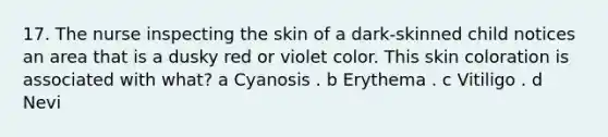 17. The nurse inspecting the skin of a dark-skinned child notices an area that is a dusky red or violet color. This skin coloration is associated with what? a Cyanosis . b Erythema . c Vitiligo . d Nevi