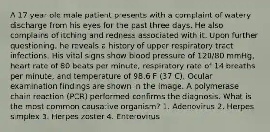 A 17-year-old male patient presents with a complaint of watery discharge from his eyes for the past three days. He also complains of itching and redness associated with it. Upon further questioning, he reveals a history of upper respiratory tract infections. His vital signs show blood pressure of 120/80 mmHg, heart rate of 80 beats per minute, respiratory rate of 14 breaths per minute, and temperature of 98.6 F (37 C). Ocular examination findings are shown in the image. A polymerase chain reaction (PCR) performed confirms the diagnosis. What is the most common causative organism? 1. Adenovirus 2. Herpes simplex 3. Herpes zoster 4. Enterovirus