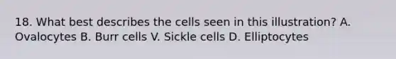 18. What best describes the cells seen in this illustration? A. Ovalocytes B. Burr cells V. Sickle cells D. Elliptocytes