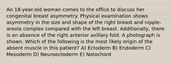 An 18-year-old woman comes to the office to discuss her congenital breast asymmetry. Physical examination shows asymmetry in the size and shape of the right breast and nipple-areola complex compared with the left breast. Additionally, there is an absence of the right anterior axillary fold. A photograph is shown. Which of the following is the most likely origin of the absent muscle in this patient? A) Ectoderm B) Endoderm C) Mesoderm D) Neuroectoderm E) Notochord