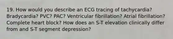 19. How would you describe an ECG tracing of tachycardia? Bradycardia? PVC? PAC? Ventricular fibrillation? Atrial fibrillation? Complete heart block? How does an S-T elevation clinically differ from and S-T segment depression?