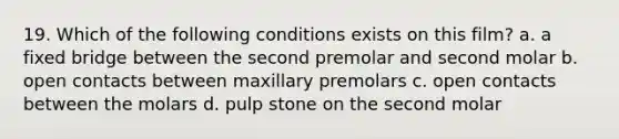 19. Which of the following conditions exists on this film? a. a fixed bridge between the second premolar and second molar b. open contacts between maxillary premolars c. open contacts between the molars d. pulp stone on the second molar