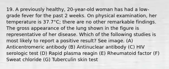 19. A previously healthy, 20-year-old woman has had a low-grade fever for the past 2 weeks. On physical examination, her temperature is 37.7°C; there are no other remarkable findings. The gross appearance of the lung shown in the figure is representative of her disease. Which of the following studies is most likely to report a positive result? See image. (A) Anticentromeric antibody (B) Antinuclear antibody (C) HIV serologic test (D) Rapid plasma reagin (E) Rheumatoid factor (F) Sweat chloride (G) Tuberculin skin test