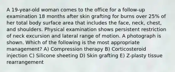 A 19-year-old woman comes to the office for a follow-up examination 18 months after skin grafting for burns over 25% of her total body surface area that includes the face, neck, chest, and shoulders. Physical examination shows persistent restriction of neck excursion and lateral range of motion. A photograph is shown. Which of the following is the most appropriate management? A) Compression therapy B) Corticosteroid injection C) Silicone sheeting D) Skin grafting E) Z-plasty tissue rearrangement