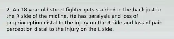 2. An 18 year old street fighter gets stabbed in the back just to the R side of the midline. He has paralysis and loss of proprioception distal to the injury on the R side and loss of pain perception distal to the injury on the L side.