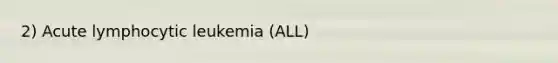 2) Acute lymphocytic leukemia (ALL)