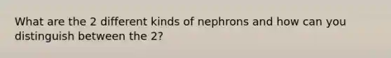 What are the 2 different kinds of nephrons and how can you distinguish between the 2?