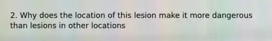 2. Why does the location of this lesion make it more dangerous than lesions in other locations