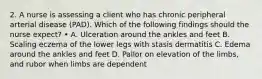 2. A nurse is assessing a client who has chronic peripheral arterial disease (PAD). Which of the following findings should the nurse expect? • A. Ulceration around the ankles and feet B. Scaling eczema of the lower legs with stasis dermatitis C. Edema around the ankles and feet D. Pallor on elevation of the limbs, and rubor when limbs are dependent