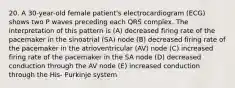 20. A 30-year-old female patient's electrocardiogram (ECG) shows two P waves preceding each QRS complex. The interpretation of this pattern is (A) decreased firing rate of the pacemaker in the sinoatrial (SA) node (B) decreased firing rate of the pacemaker in the atrioventricular (AV) node (C) increased firing rate of the pacemaker in the SA node (D) decreased conduction through the AV node (E) increased conduction through the His- Purkinje system