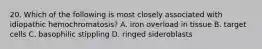 20. Which of the following is most closely associated with idiopathic hemochromatosis? A. iron overload in tissue B. target cells C. basophilic stippling D. ringed sideroblasts