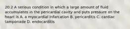 20.2 A serious condition in which a large amount of fluid accumulates in the pericardial cavity and puts pressure on the heart is A. a myocardial infarcation B. pericarditis C. cardiac tamponade D. endocarditis