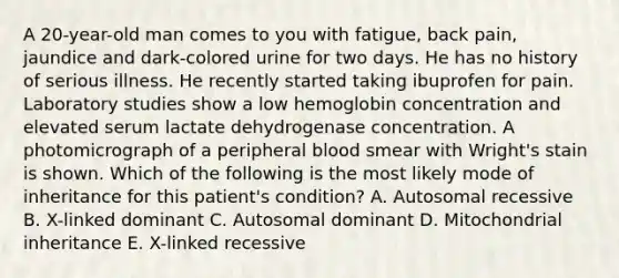 A 20-year-old man comes to you with fatigue, back pain, jaundice and dark-colored urine for two days. He has no history of serious illness. He recently started taking ibuprofen for pain. Laboratory studies show a low hemoglobin concentration and elevated serum lactate dehydrogenase concentration. A photomicrograph of a peripheral blood smear with Wright's stain is shown. Which of the following is the most likely mode of inheritance for this patient's condition? A. Autosomal recessive B. X-linked dominant C. Autosomal dominant D. Mitochondrial inheritance E. X-linked recessive