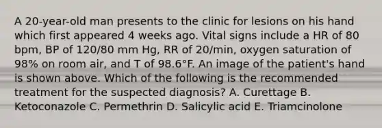 A 20-year-old man presents to the clinic for lesions on his hand which first appeared 4 weeks ago. Vital signs include a HR of 80 bpm, BP of 120/80 mm Hg, RR of 20/min, oxygen saturation of 98% on room air, and T of 98.6°F. An image of the patient's hand is shown above. Which of the following is the recommended treatment for the suspected diagnosis? A. Curettage B. Ketoconazole C. Permethrin D. Salicylic acid E. Triamcinolone