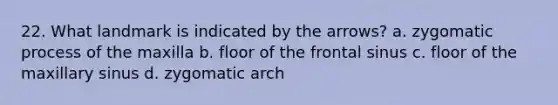 22. What landmark is indicated by the arrows? a. zygomatic process of the maxilla b. floor of the frontal sinus c. floor of the maxillary sinus d. zygomatic arch