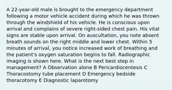 A 22-year-old male is brought to the emergency department following a motor vehicle accident during which he was thrown through the windshield of his vehicle. He is conscious upon arrival and complains of severe right-sided chest pain. His vital signs are stable upon arrival. On auscultation, you note absent breath sounds on the right middle and lower chest. Within 5 minutes of arrival, you notice increased work of breathing and the patient's oxygen saturation begins to fall. Radiographic imaging is shown here. What is the next best step in management? A Observation alone B Pericardiocentesis C Thoracostomy tube placement D Emergency bedside thoracotomy E Diagnostic laparotomy