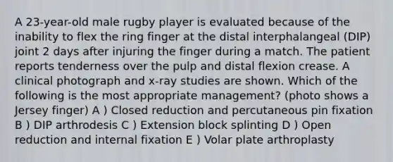 A 23-year-old male rugby player is evaluated because of the inability to flex the ring finger at the distal interphalangeal (DIP) joint 2 days after injuring the finger during a match. The patient reports tenderness over the pulp and distal flexion crease. A clinical photograph and x-ray studies are shown. Which of the following is the most appropriate management? (photo shows a Jersey finger) A ) Closed reduction and percutaneous pin fixation B ) DIP arthrodesis C ) Extension block splinting D ) Open reduction and internal fixation E ) Volar plate arthroplasty