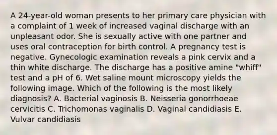 A 24-year-old woman presents to her primary care physician with a complaint of 1 week of increased vaginal discharge with an unpleasant odor. She is sexually active with one partner and uses oral contraception for birth control. A pregnancy test is negative. Gynecologic examination reveals a pink cervix and a thin white discharge. The discharge has a positive amine "whiff" test and a pH of 6. Wet saline mount microscopy yields the following image. Which of the following is the most likely diagnosis? A. Bacterial vaginosis B. Neisseria gonorrhoeae cervicitis C. Trichomonas vaginalis D. Vaginal candidiasis E. Vulvar candidiasis