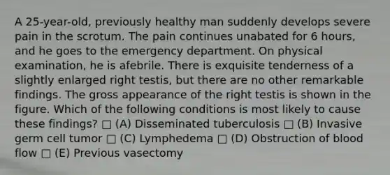 A 25-year-old, previously healthy man suddenly develops severe pain in the scrotum. The pain continues unabated for 6 hours, and he goes to the emergency department. On physical examination, he is afebrile. There is exquisite tenderness of a slightly enlarged right testis, but there are no other remarkable findings. The gross appearance of the right testis is shown in the figure. Which of the following conditions is most likely to cause these findings? □ (A) Disseminated tuberculosis □ (B) Invasive germ cell tumor □ (C) Lymphedema □ (D) Obstruction of blood flow □ (E) Previous vasectomy