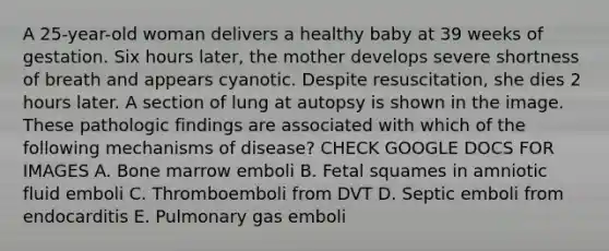 A 25-year-old woman delivers a healthy baby at 39 weeks of gestation. Six hours later, the mother develops severe shortness of breath and appears cyanotic. Despite resuscitation, she dies 2 hours later. A section of lung at autopsy is shown in the image. These pathologic findings are associated with which of the following mechanisms of disease? CHECK GOOGLE DOCS FOR IMAGES A. Bone marrow emboli B. Fetal squames in amniotic fluid emboli C. Thromboemboli from DVT D. Septic emboli from endocarditis E. Pulmonary gas emboli