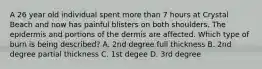 A 26 year old individual spent more than 7 hours at Crystal Beach and now has painful blisters on both shoulders. The epidermis and portions of the dermis are affected. Which type of burn is being described? A. 2nd degree full thickness B. 2nd degree partial thickness C. 1st degee D. 3rd degree